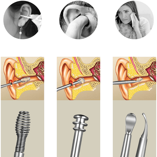EAR CLEANING SET – Fültisztító készlet 03
